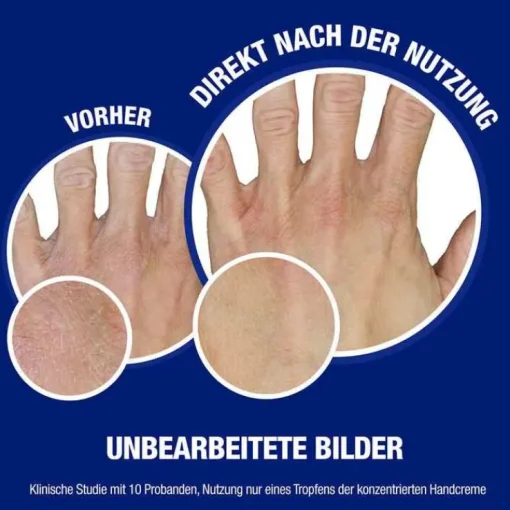Neutrogena norwegische Formel Hand & Nagel Creme, 75 ml