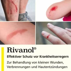 Rivanol 1,0 g Pulver, 50 St