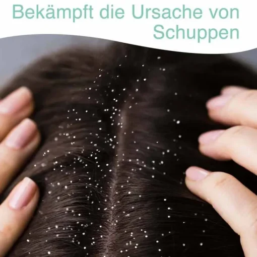 Stieprox Shampoo, 100 ml